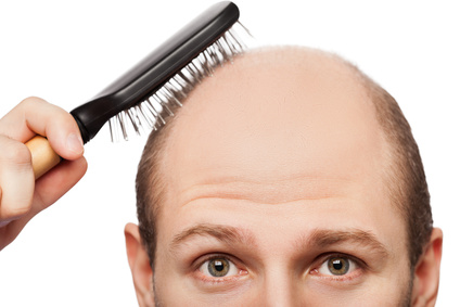 Hair Loss Treatments for Men and Women