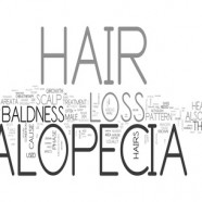 Hair Loss Alopecia