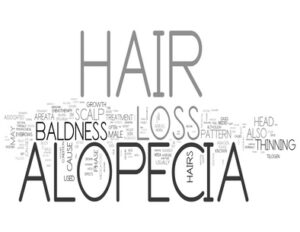 Hair Loss Alopecia