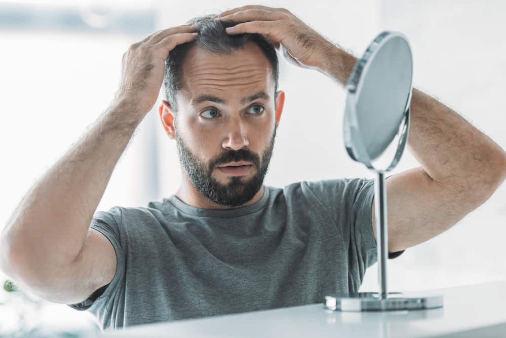 Combatting Male Pattern Baldness The Ultimate Guide To Hair Restoration For Men